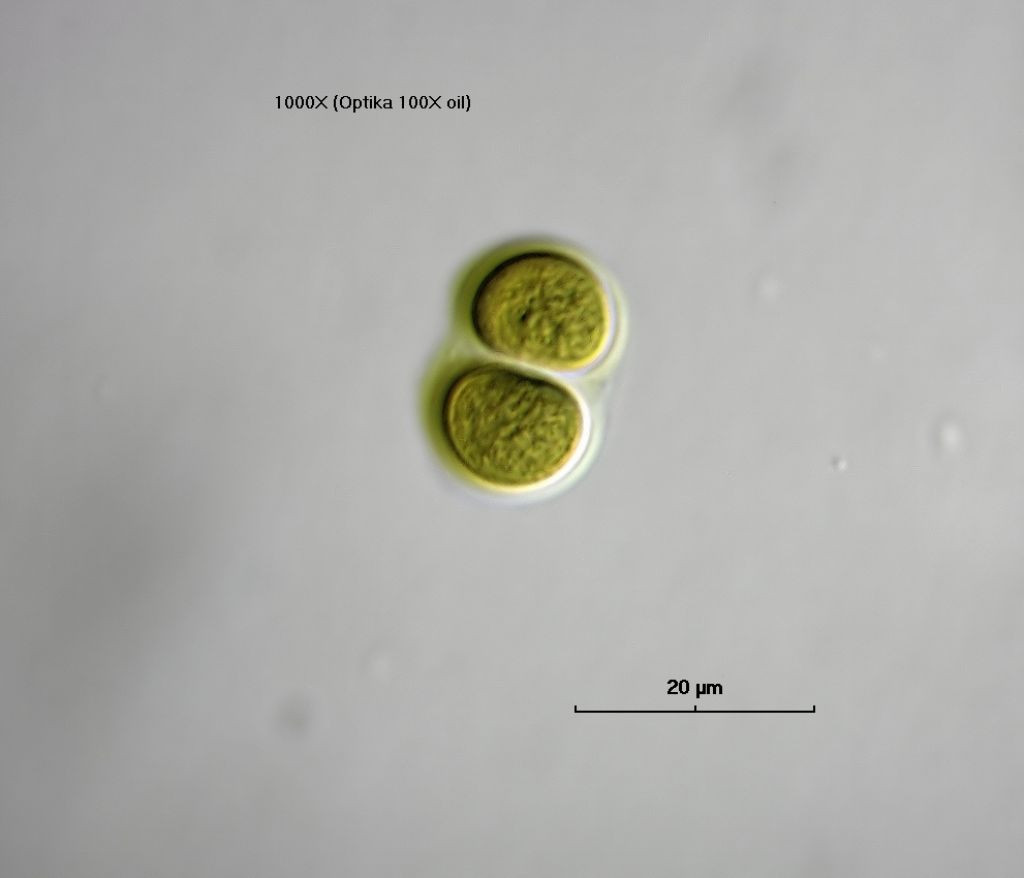 Chroococcus turgidus